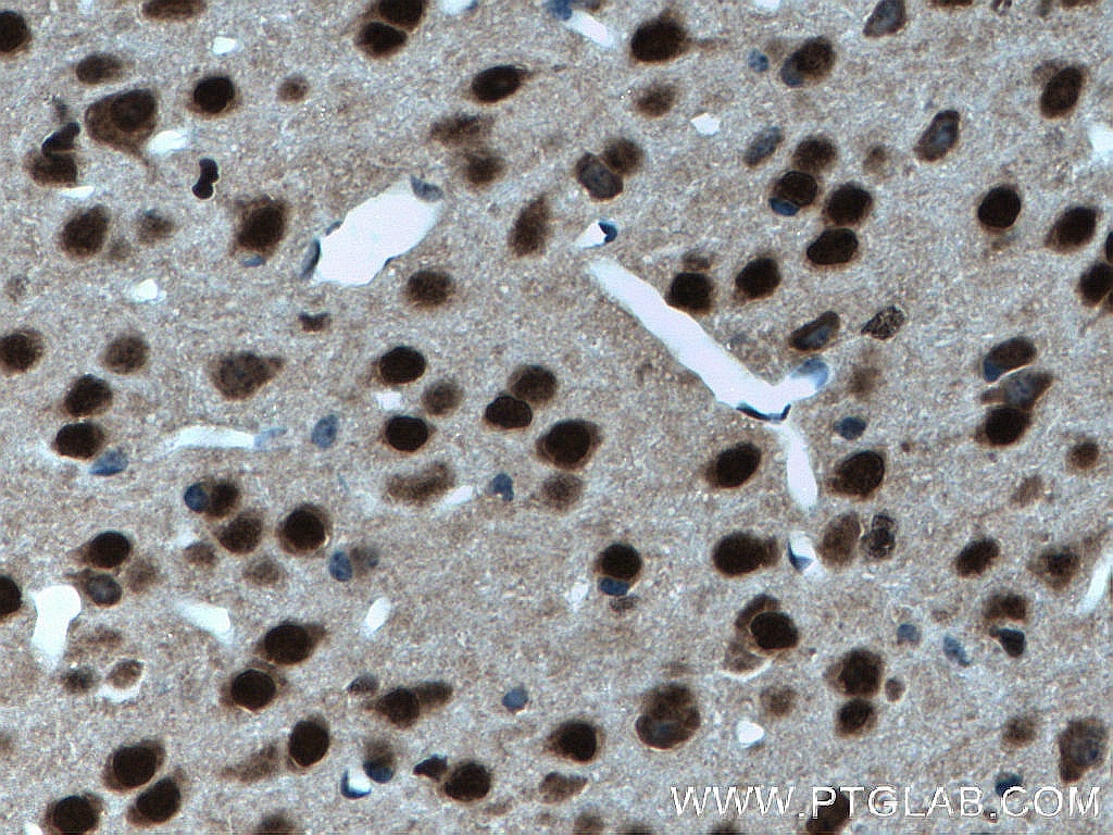 Immunohistochemistry (IHC) staining of mouse brain tissue using SUPT7L Polyclonal antibody (25606-1-AP)