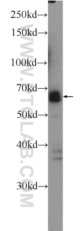 Western Blot (WB) analysis of HeLa cells using SUPT7L Polyclonal antibody (25606-1-AP)