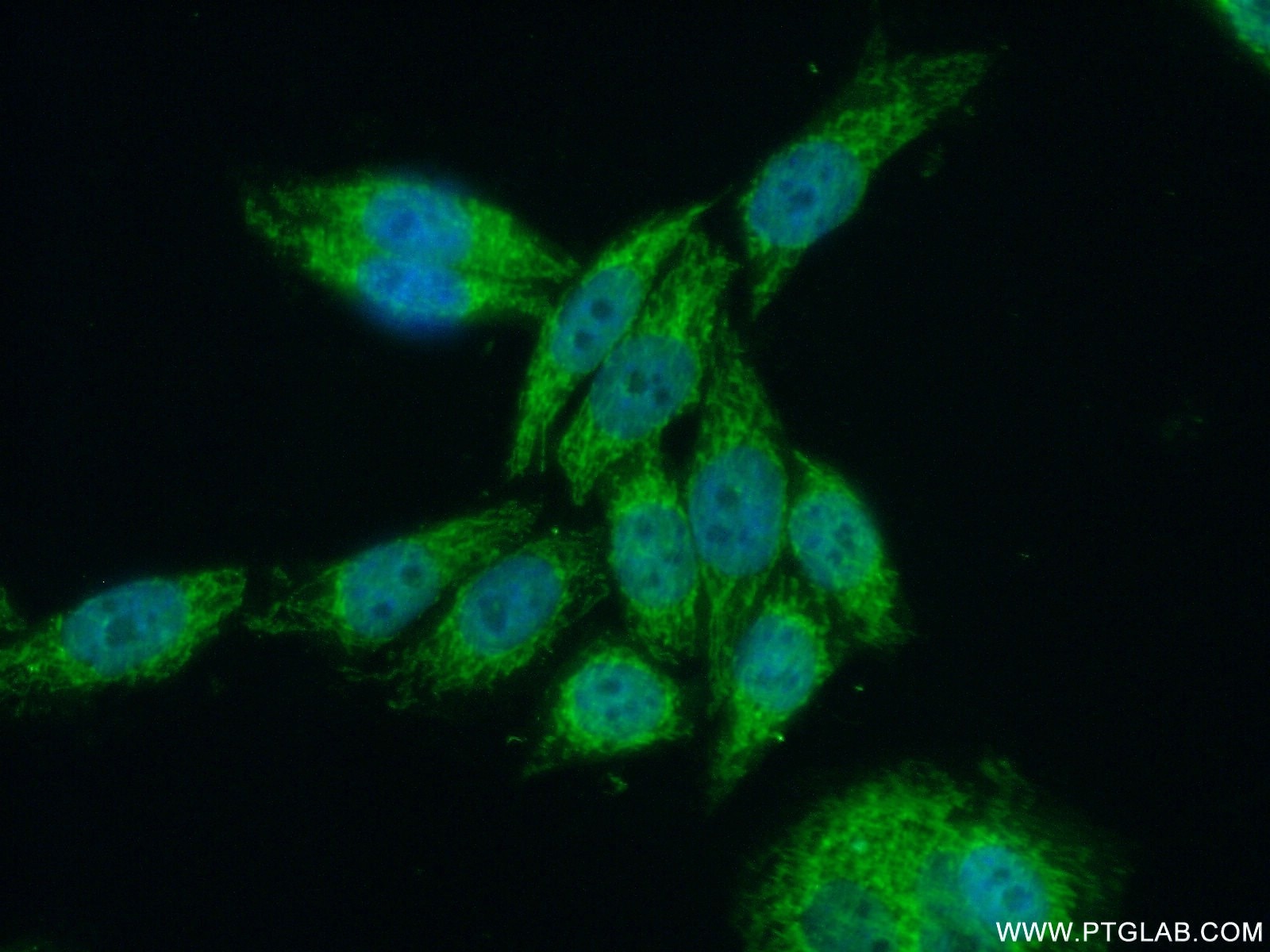 Immunofluorescence (IF) / fluorescent staining of HeLa cells using SUPV3L1 Polyclonal antibody (12826-1-AP)
