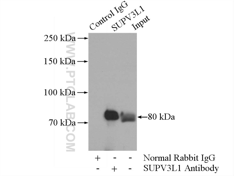 Immunoprecipitation (IP) experiment of HeLa cells using SUPV3L1 Polyclonal antibody (12826-1-AP)