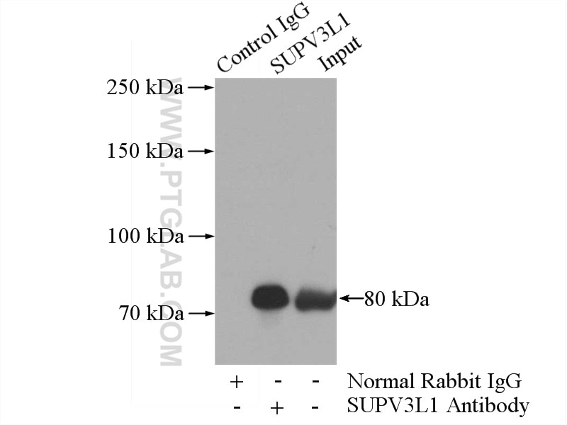 Immunoprecipitation (IP) experiment of HeLa cells using SUPV3L1 Polyclonal antibody (12826-1-AP)