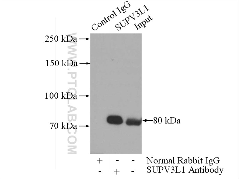 Immunoprecipitation (IP) experiment of HeLa cells using SUPV3L1 Polyclonal antibody (12826-1-AP)