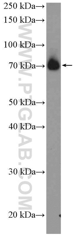 Western Blot (WB) analysis of HeLa cells using SUPV3L1 Polyclonal antibody (12826-1-AP)