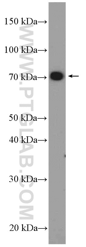 Western Blot (WB) analysis of PC-3 cells using SUPV3L1 Polyclonal antibody (12826-1-AP)