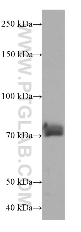 Western Blot (WB) analysis of HeLa cells using SUPV3L1 Polyclonal antibody (12826-1-AP)