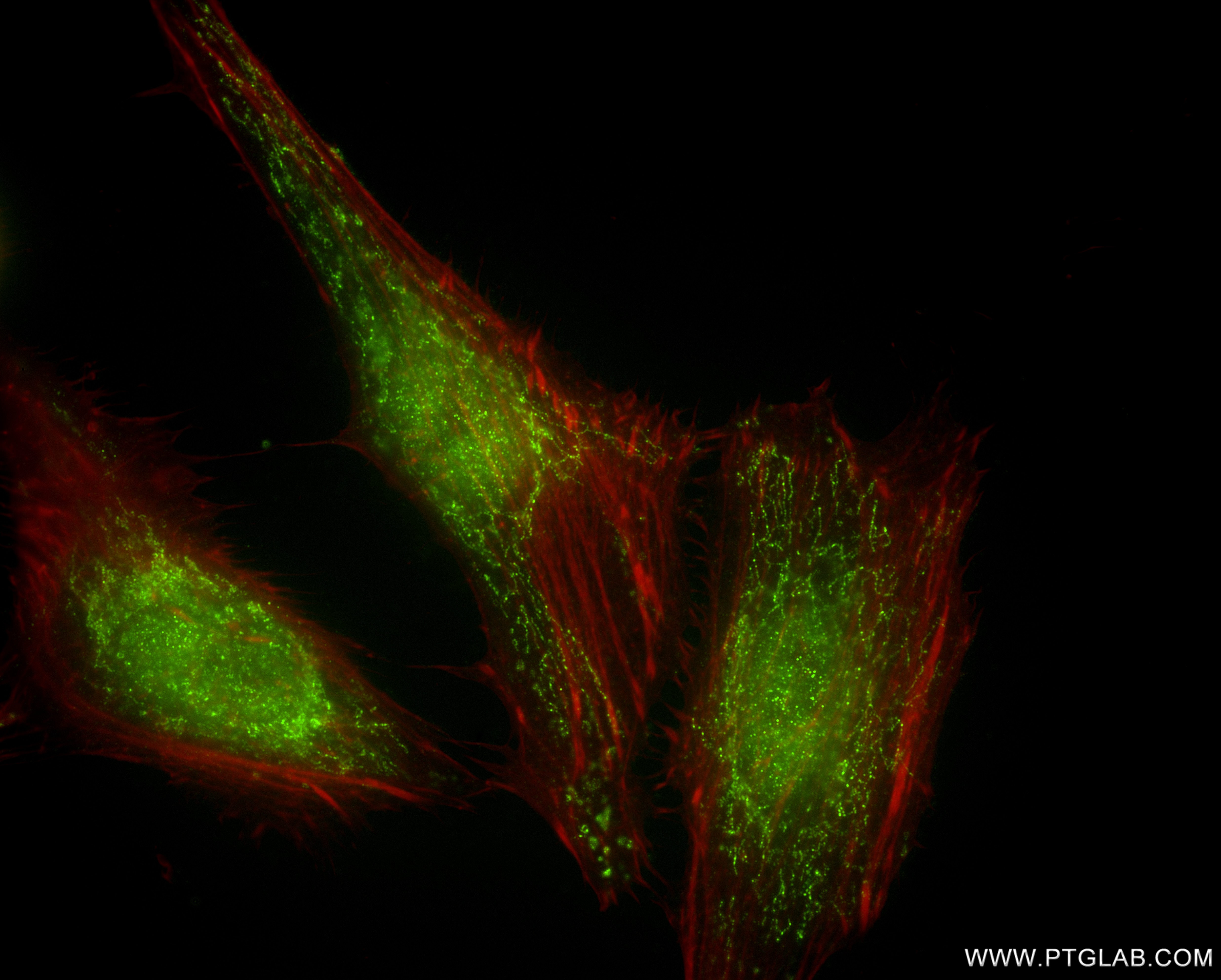 Immunofluorescence (IF) / fluorescent staining of HeLa cells using SUPV3L1 Recombinant monoclonal antibody (86706-1-RR)