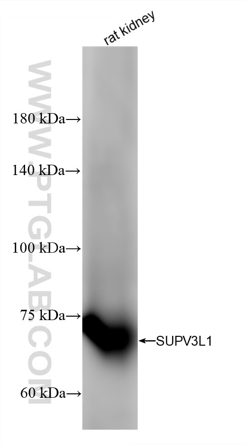 Western Blot (WB) analysis of rat kidney tissue using SUPV3L1 Recombinant monoclonal antibody (86706-1-RR)