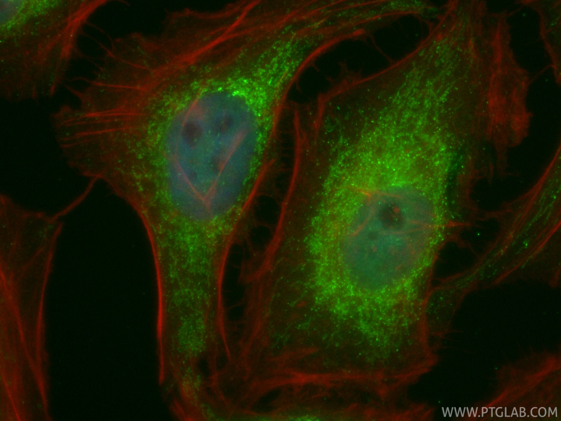 IF Staining of HeLa using CL488-86706 Immunofluorescence (IF) / fluorescent staining of HeLa cells using CoraLite® Plus 488-conjugated SUPV3L1 Recombinant (CL488-86706)
