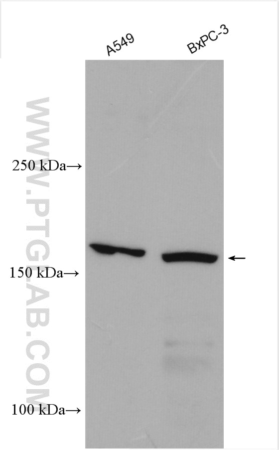 Western Blot (WB) analysis of various lysates using SUR1 Polyclonal antibody (55172-1-AP)