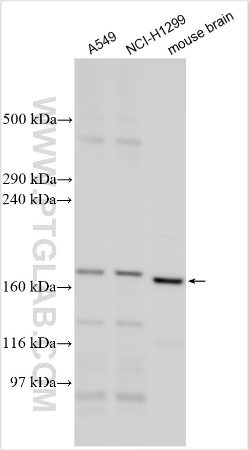 Western Blot (WB) analysis of various lysates using SUR1 Polyclonal antibody (55172-1-AP)