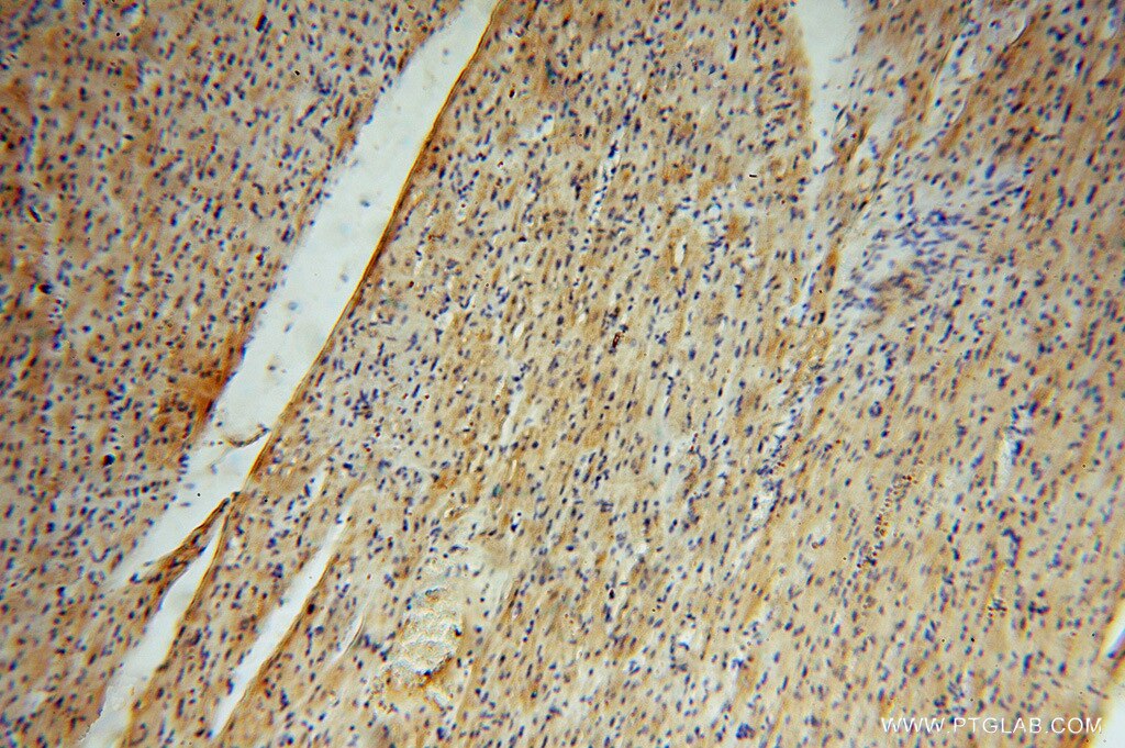 IHC staining of human heart using 15379-1-AP