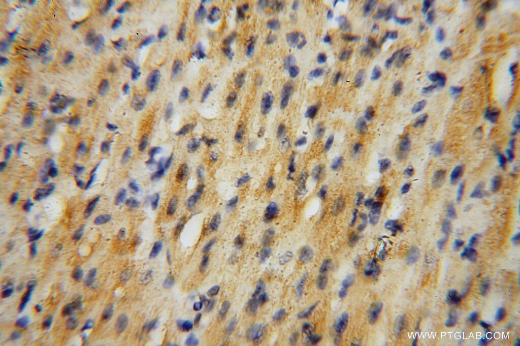 Immunohistochemistry (IHC) staining of human heart tissue using SURF1 Polyclonal antibody (15379-1-AP)