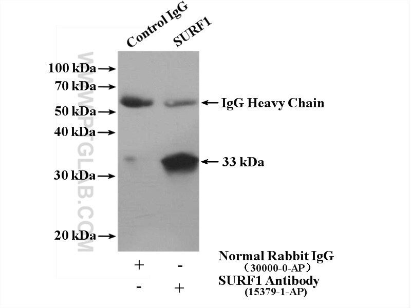 Immunoprecipitation (IP) experiment of HeLa cells using SURF1 Polyclonal antibody (15379-1-AP)