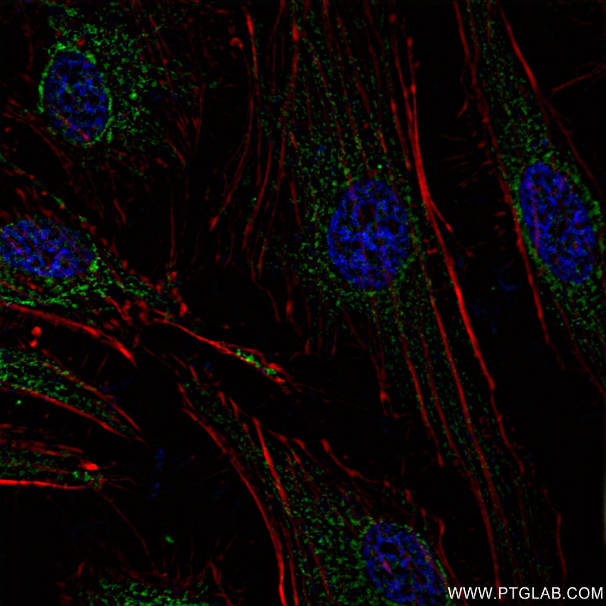 Immunofluorescence (IF) / fluorescent staining of HeLa cells using SURF1 Recombinant antibody (83052-5-RR)