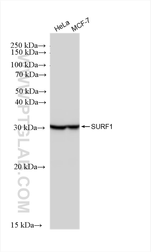 Western Blot (WB) analysis of various lysates using SURF1 Recombinant antibody (83052-6-RR)