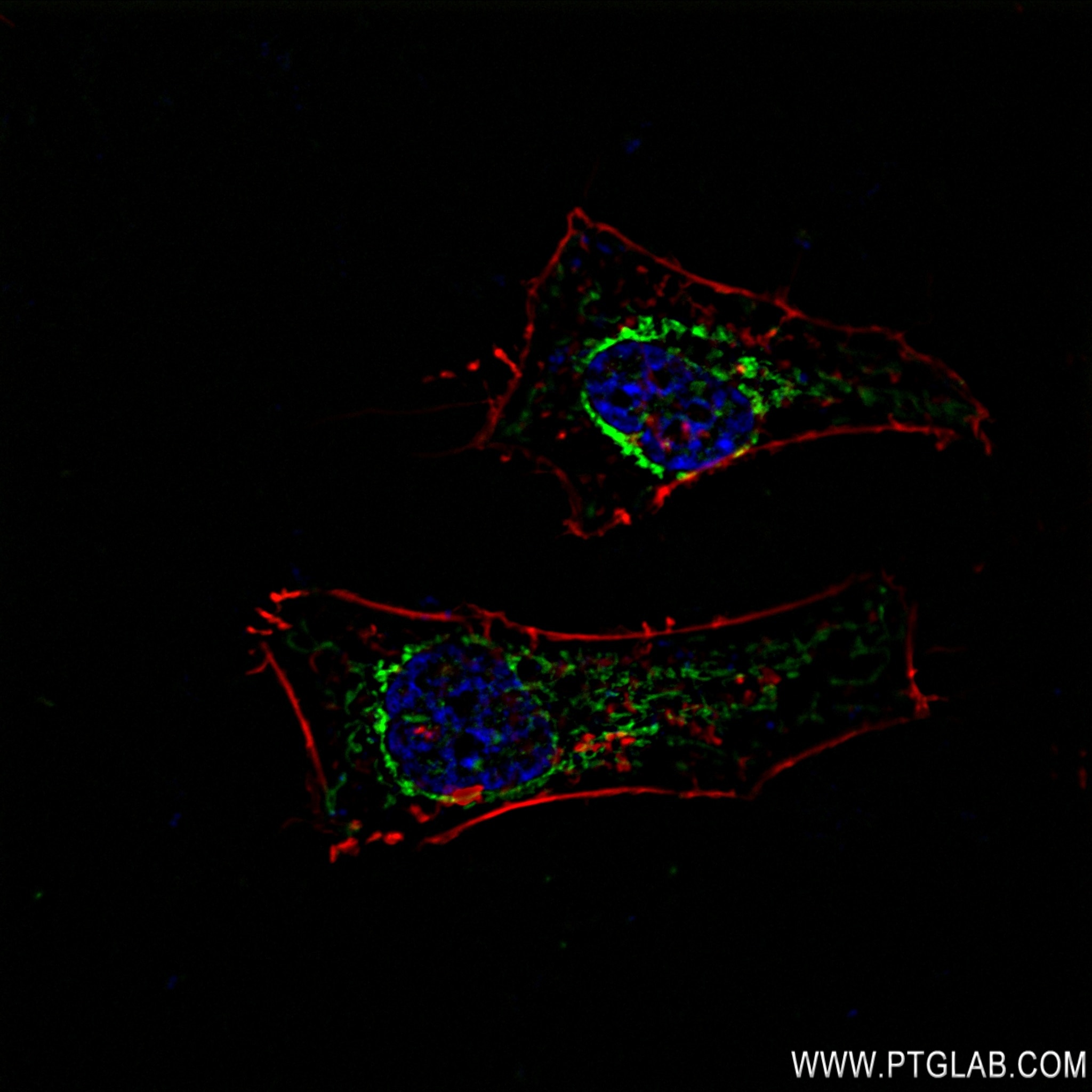 IF Staining of HeLa using 83052-7-RR