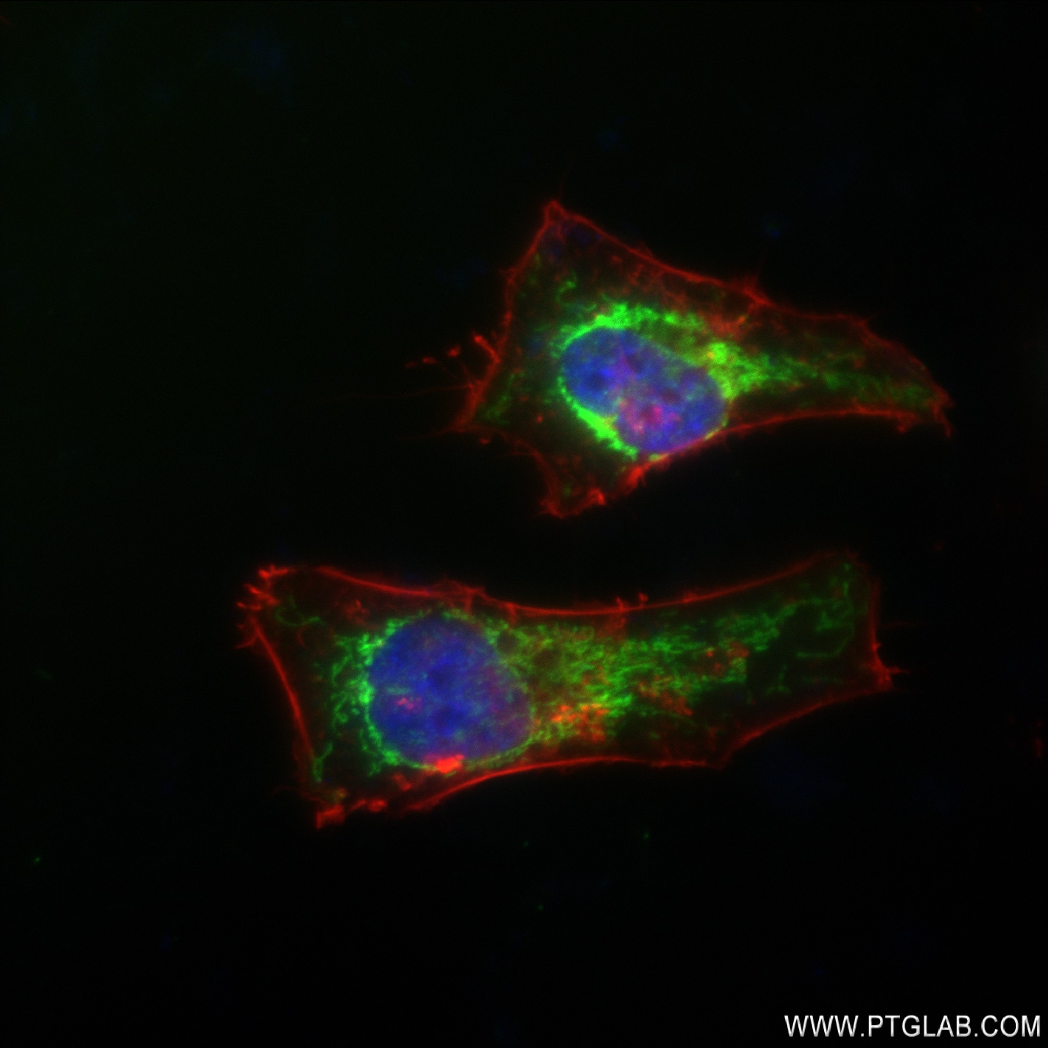 IF Staining of HeLa using 83052-7-RR