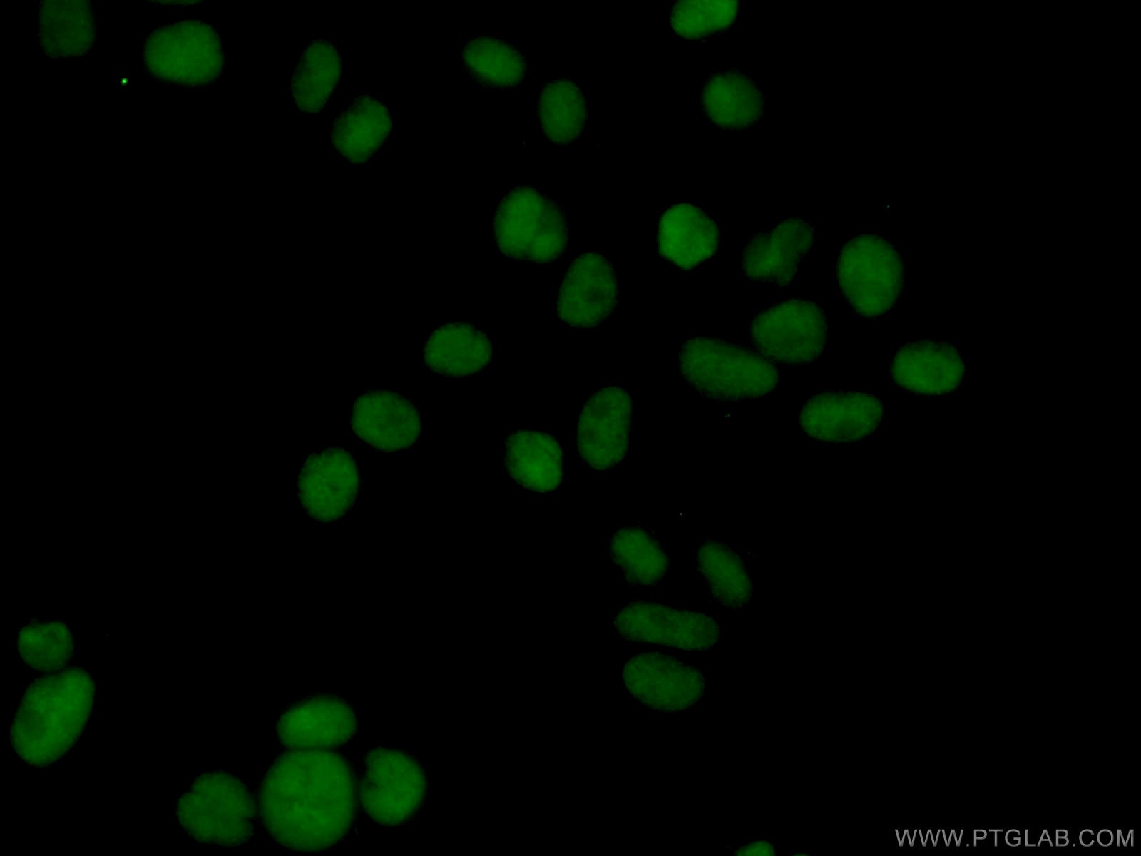 Immunofluorescence (IF) / fluorescent staining of HeLa cells using SURF2 Polyclonal antibody (16522-1-AP)