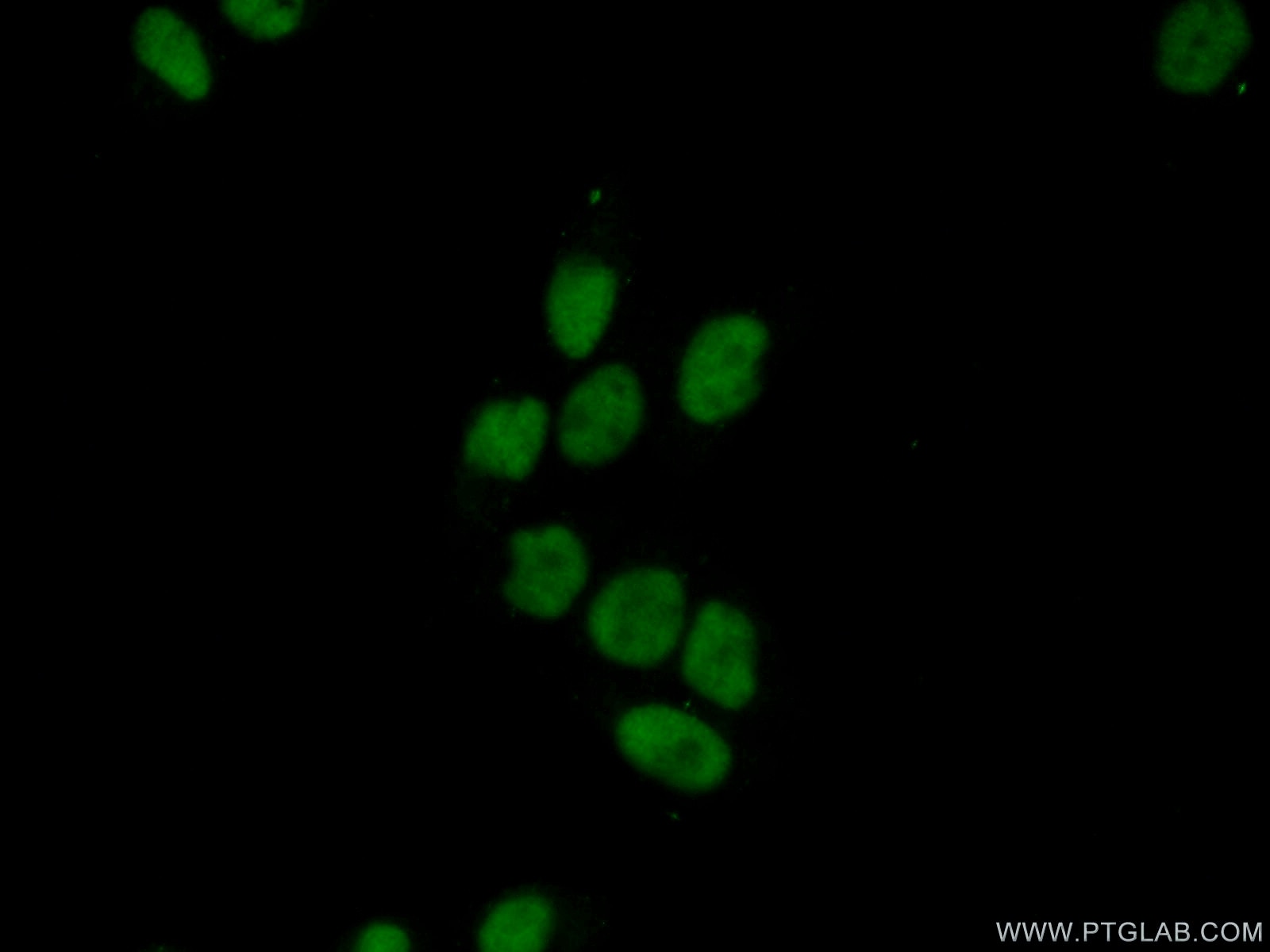 IF Staining of HeLa using 16522-1-AP