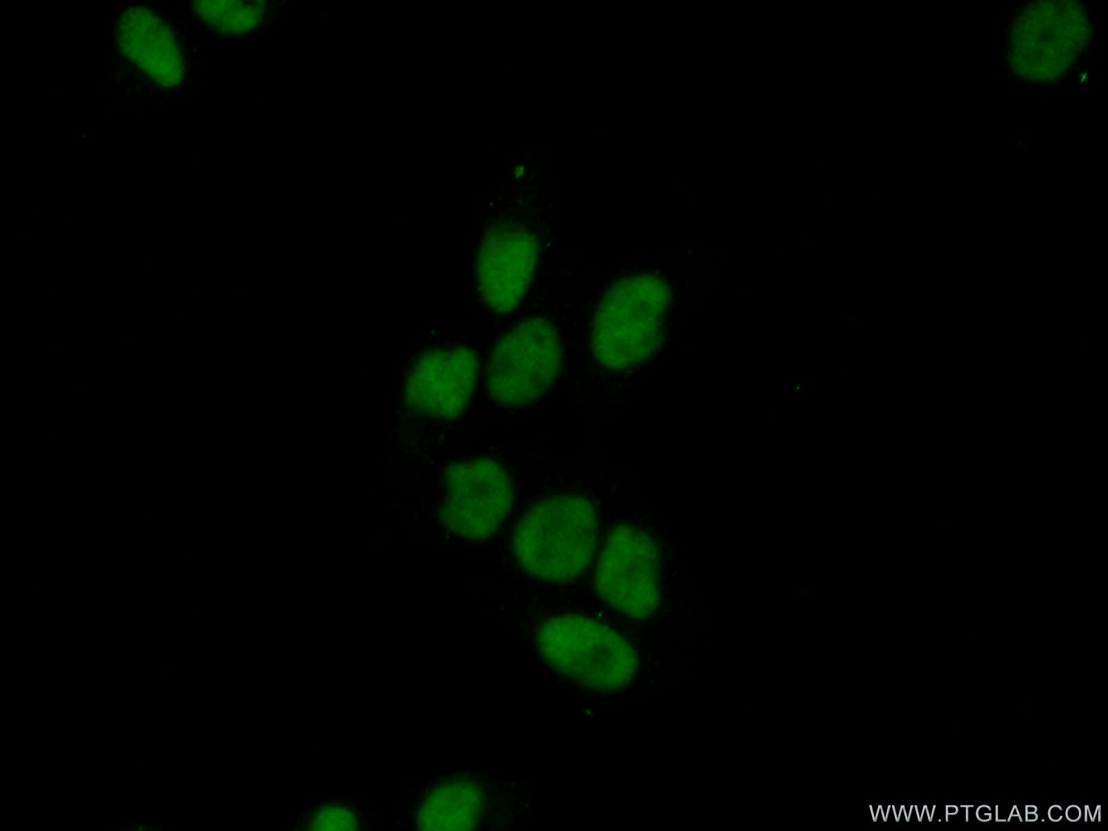 Immunofluorescence (IF) / fluorescent staining of HeLa cells using SURF2 Polyclonal antibody (16522-1-AP)