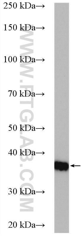 WB analysis of HeLa using 16522-1-AP