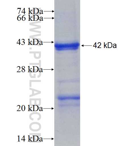 SURF2 fusion protein Ag9479 SDS-PAGE