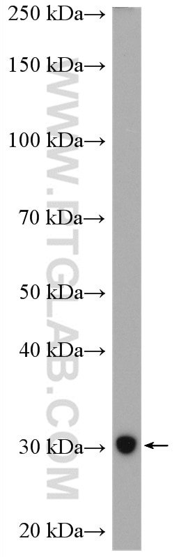 Western Blot (WB) analysis of mouse brain tissue using SURF4 Polyclonal antibody (11599-1-AP)