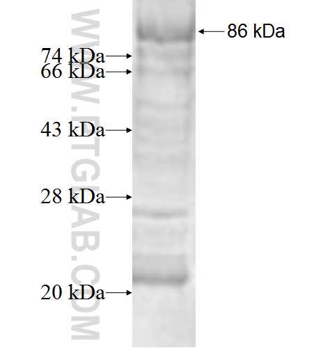SURF4 fusion protein Ag2175 SDS-PAGE