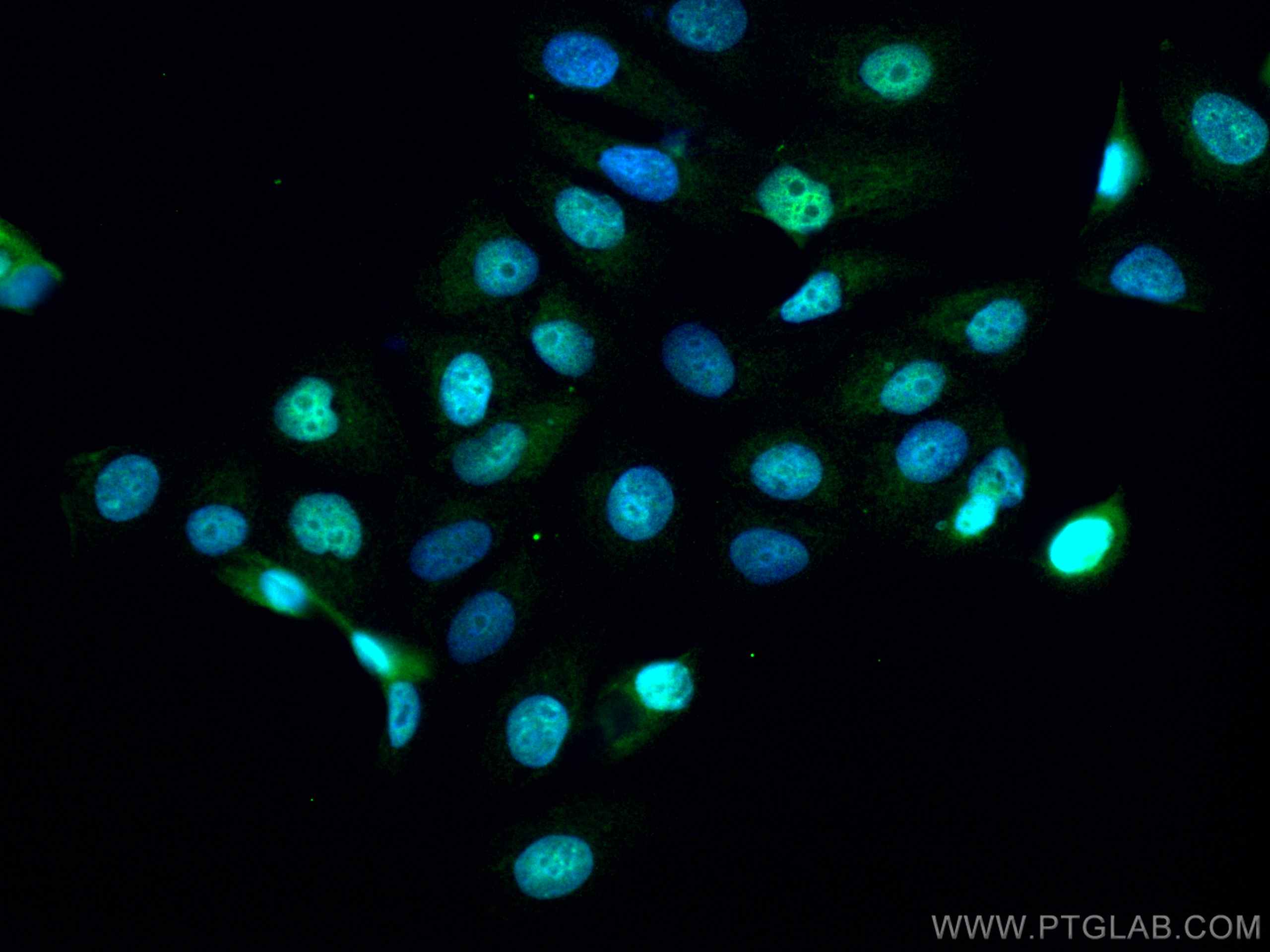 Immunofluorescence (IF) / fluorescent staining of MCF-7 cells using SURVIVIN Polyclonal antibody (10508-1-AP)
