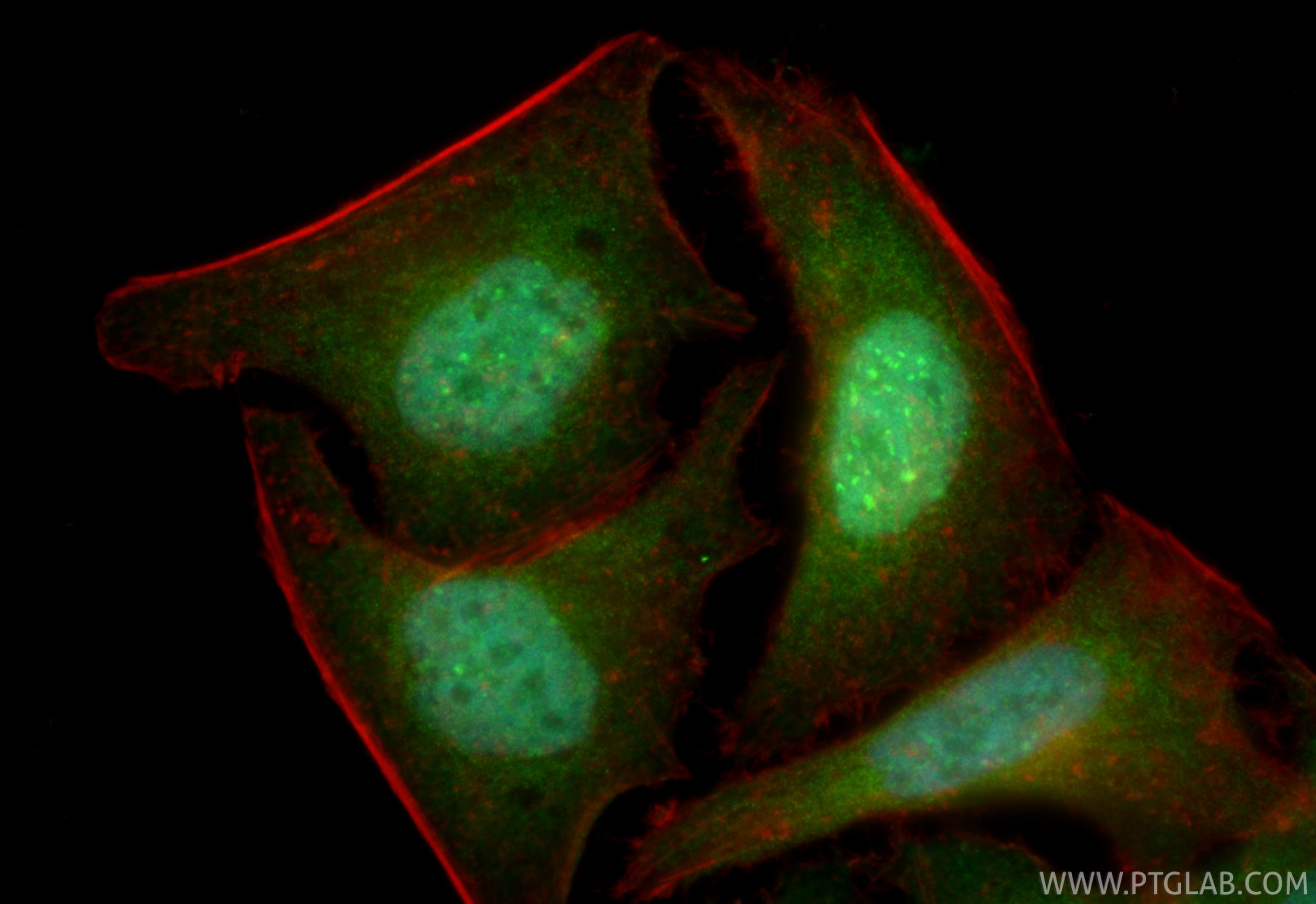 Immunofluorescence (IF) / fluorescent staining of HeLa cells using SURVIVIN Polyclonal antibody (10508-1-AP)