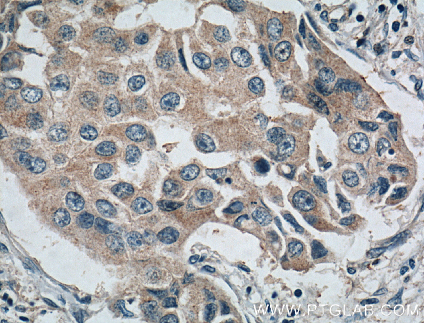 SURVIVIN Polyclonal antibody