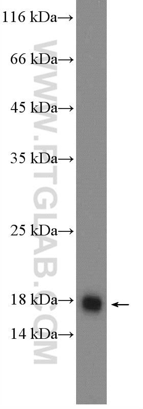 SURVIVIN Polyclonal antibody