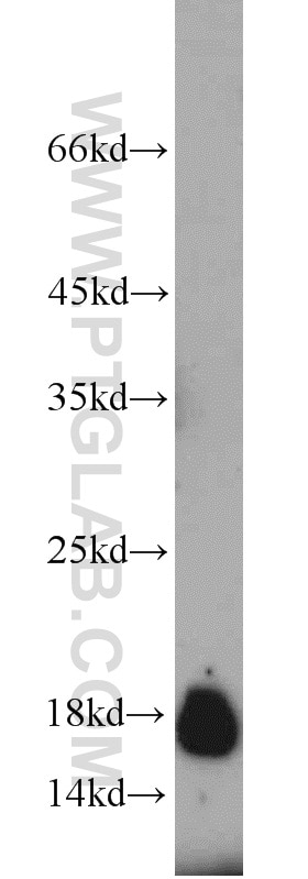 Western Blot (WB) analysis of PC-3 cells using SURVIVIN Polyclonal antibody (10508-1-AP)