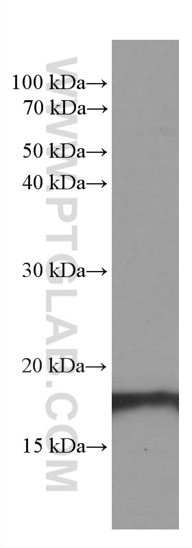 Western Blot (WB) analysis of Raji cells using SURVIVIN Monoclonal antibody (66495-1-Ig)