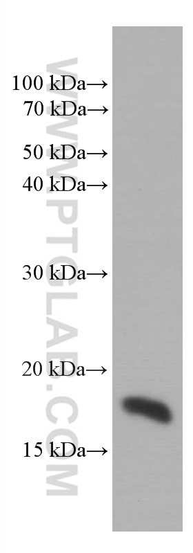 Western Blot (WB) analysis of K-562 cells using SURVIVIN Monoclonal antibody (66495-1-Ig)