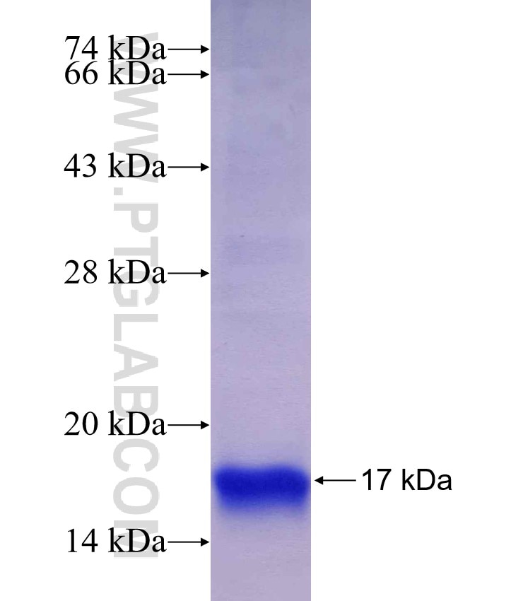 SURVIVIN fusion protein Ag29598 SDS-PAGE