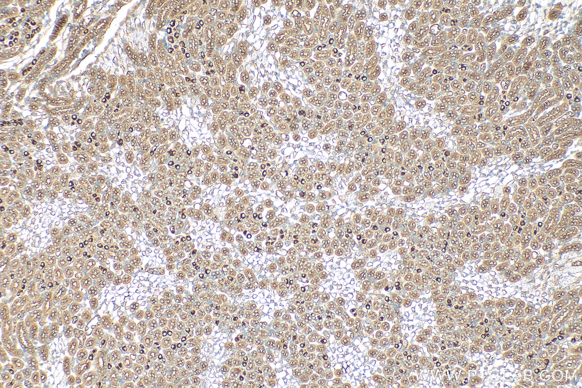 Immunohistochemistry (IHC) staining of mouse kidney tissue using SUSD2 Polyclonal antibody (30711-1-AP)