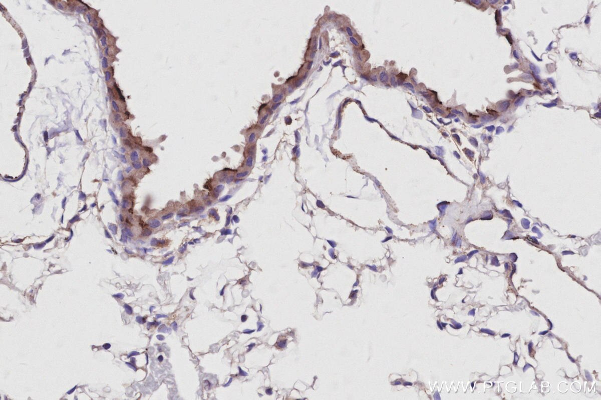 Immunohistochemistry (IHC) staining of mouse lung tissue using SUSD2 Polyclonal antibody (30711-1-AP)