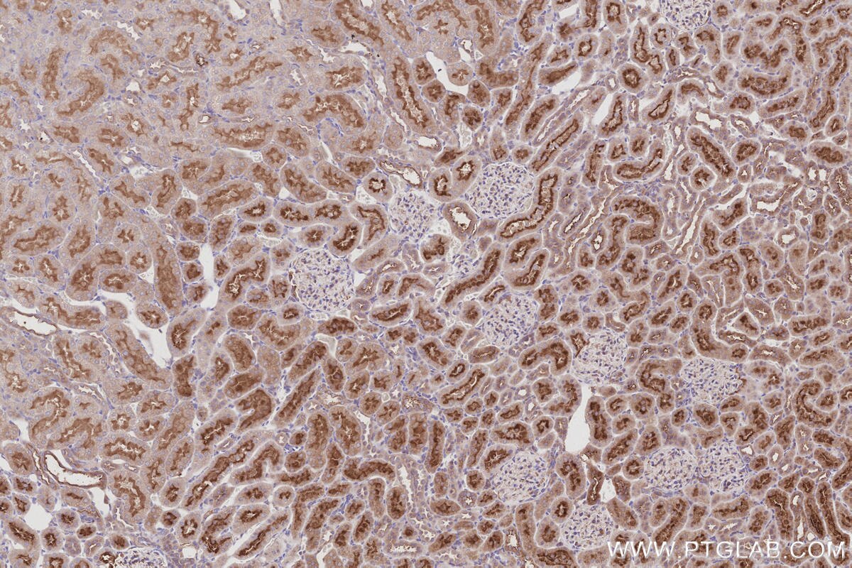 Immunohistochemistry (IHC) staining of rat kidney tissue using SUSD2 Polyclonal antibody (30711-1-AP)