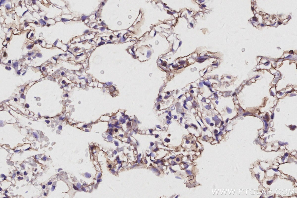 Immunohistochemistry (IHC) staining of rat lung tissue using SUSD2 Polyclonal antibody (30711-1-AP)