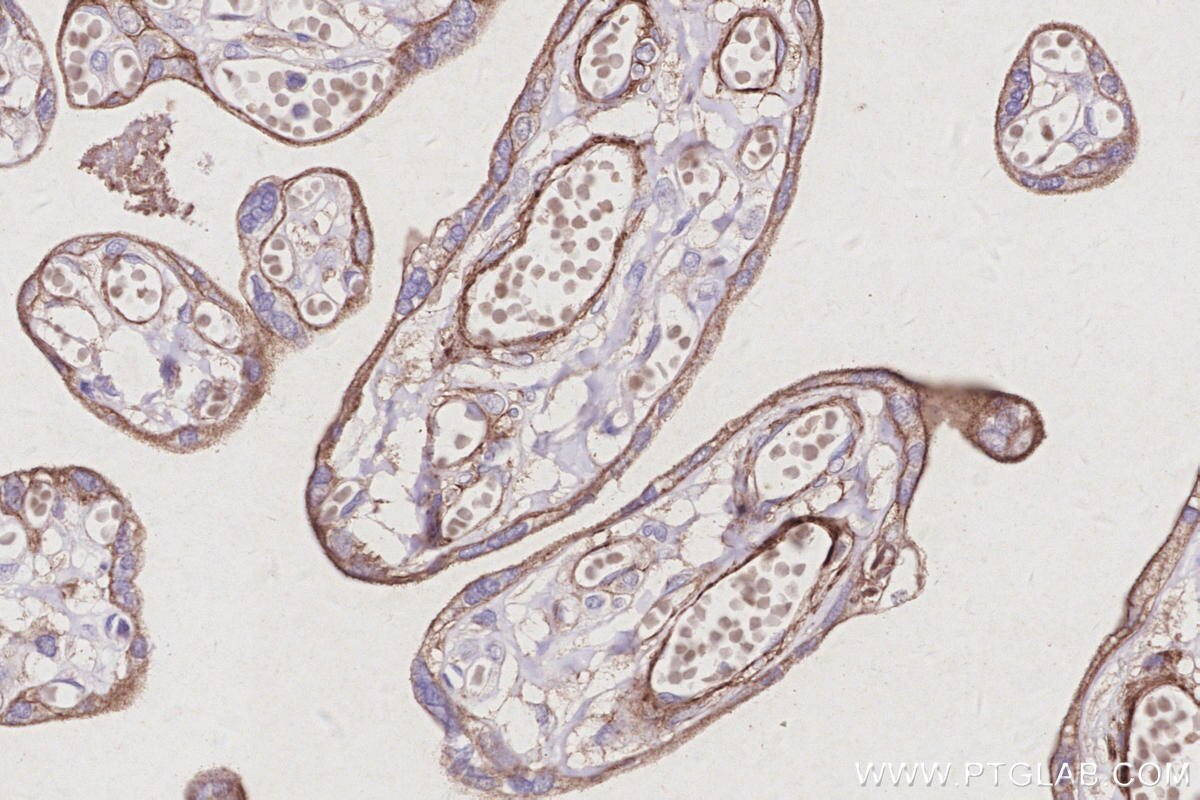 Immunohistochemistry (IHC) staining of human placenta tissue using SUSD2 Polyclonal antibody (30711-1-AP)