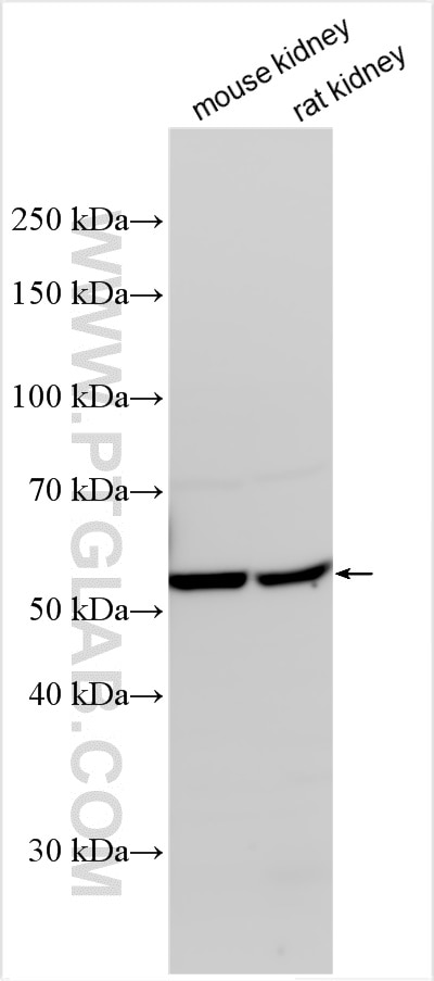 Western Blot (WB) analysis of various lysates using SUSD2 Polyclonal antibody (30711-1-AP)