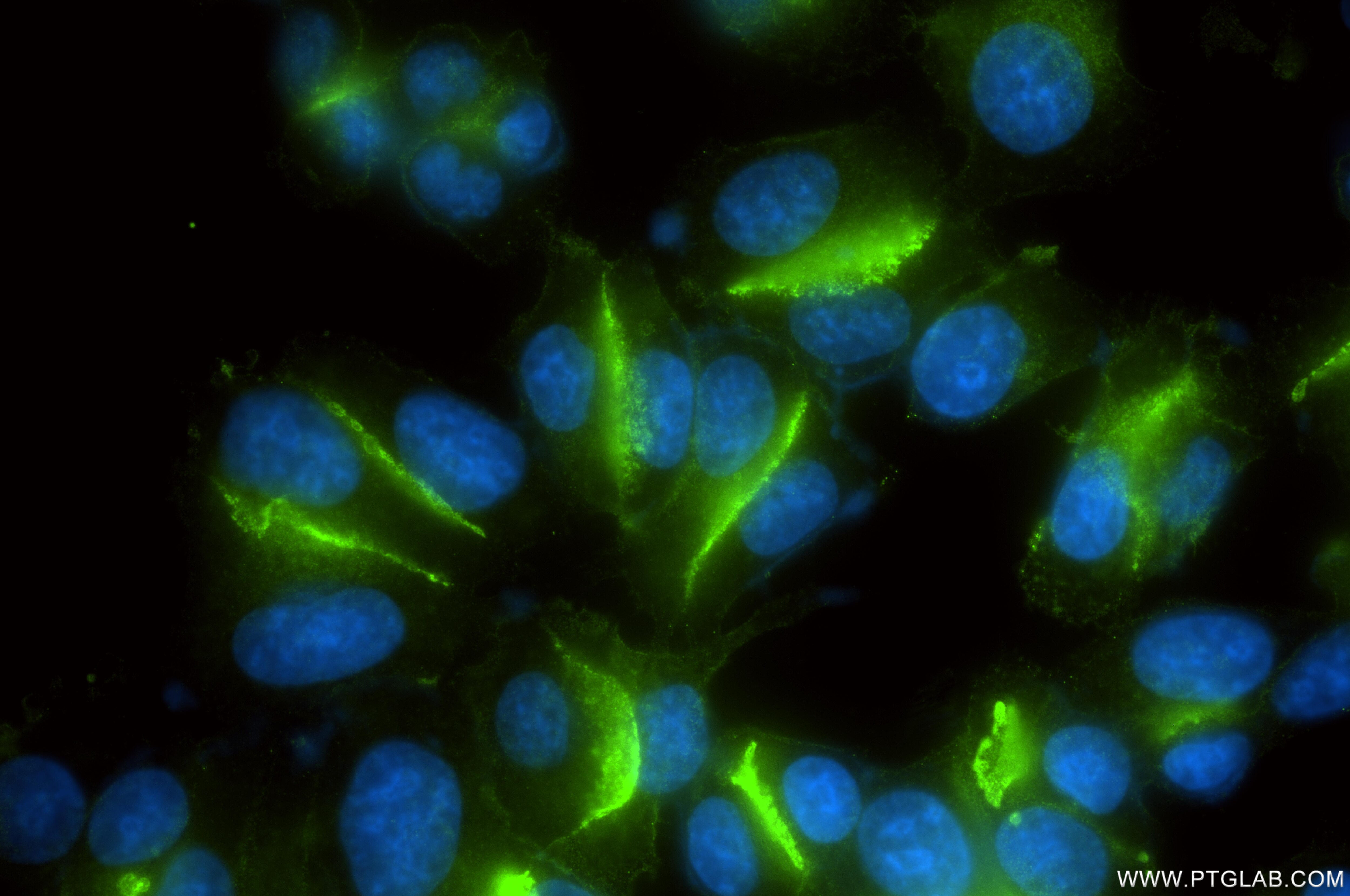 Immunofluorescence (IF) / fluorescent staining of SK-BR-3 cells using SUSD2 Recombinant monoclonal antibody (84852-4-RR)