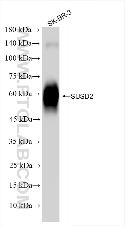 Western Blot (WB) analysis of SK-BR-3 cells using SUSD2 Recombinant antibody (84852-4-RR)
