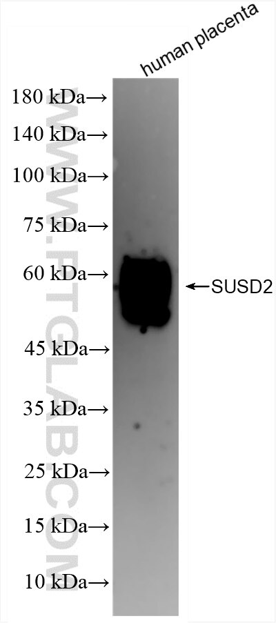 SUSD2