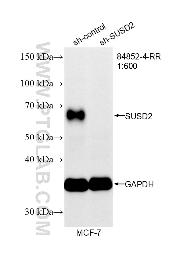 WB analysis of MCF-7 using 84852-4-RR Western Blot (WB) analysis of MCF-7 cells using SUSD2 Recombinant monoclonal antibody (84852-4-RR)
