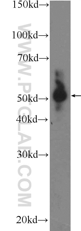 Western Blot (WB) analysis of C6 cells using SUV39H1 Polyclonal antibody (10574-1-AP)