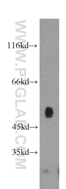 Western Blot (WB) analysis of mouse small intestine tissue using SUV39H1 Polyclonal antibody (10574-1-AP)