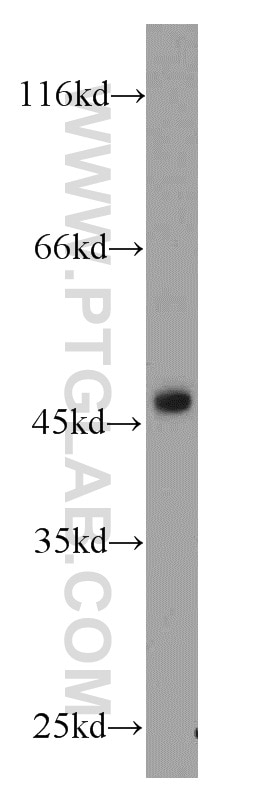 Western Blot (WB) analysis of HEK-293 cells using SUV39H1 Polyclonal antibody (10574-1-AP)