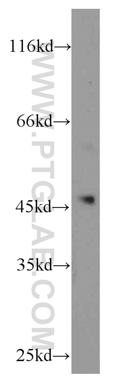 Western Blot (WB) analysis of HeLa cells using SUV39H1 Polyclonal antibody (10574-1-AP)